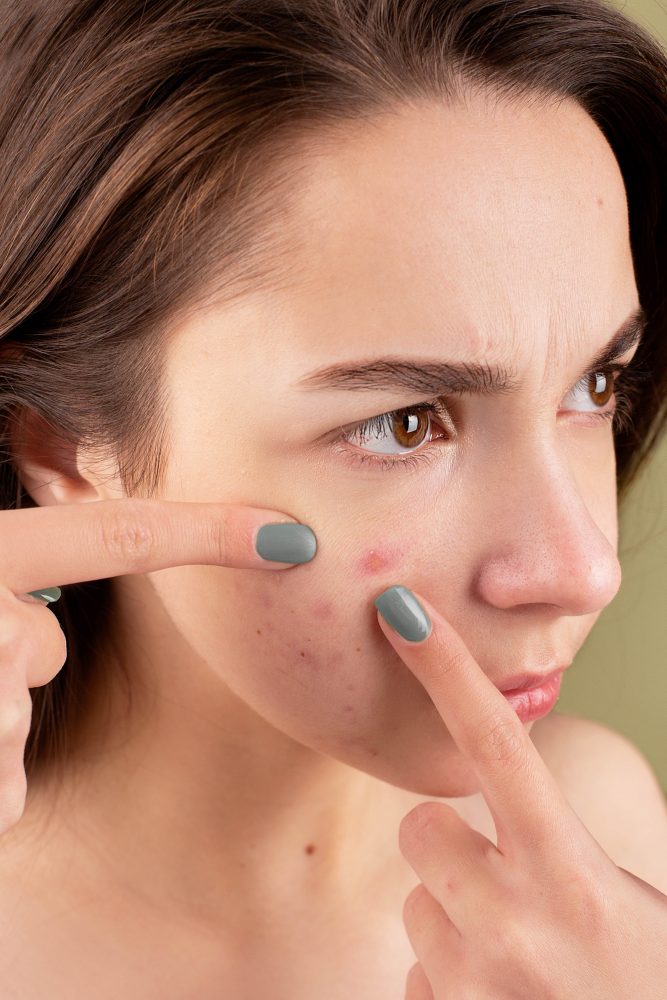 Slugging skincare: does it really work? Find out here!